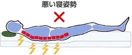 悪い寝姿勢